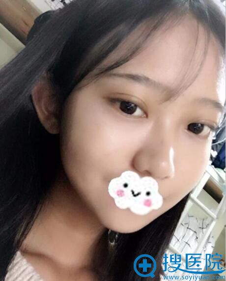 改变的不仅是眼睛,也是心情 改变的不仅是眼睛,也是心情