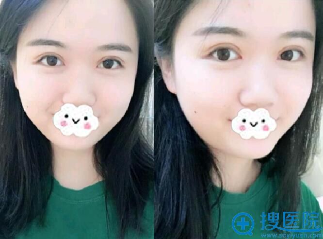眼睛很自然,像不像天生的? 眼睛很自然,像不像天生的?