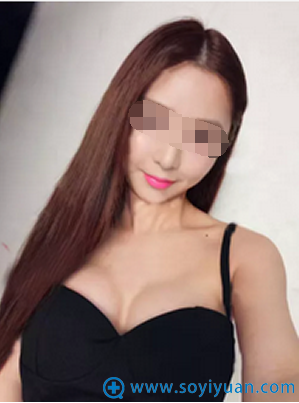 福州名韩陈声瑾自体脂肪丰胸恢复后效果 福州名韩陈声瑾自体脂肪丰胸恢复后效果