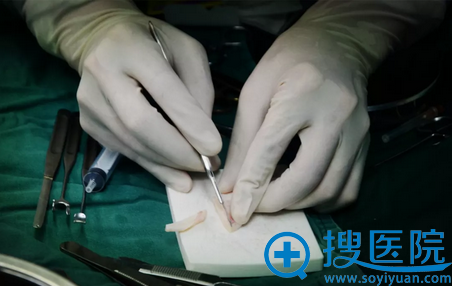 手术第三步:雕刻肋软骨 手术第三步:雕刻肋软骨