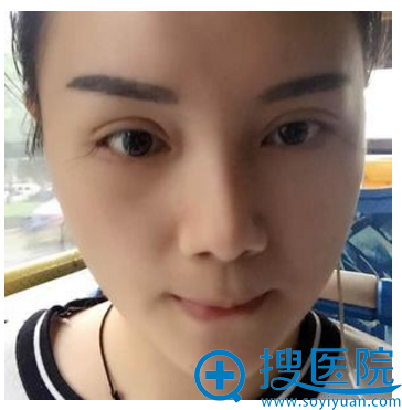 双眼皮7天自拍 双眼皮7天自拍