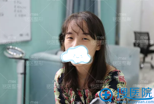 手术前的橙子是小眼睛、眯眯眼 手术前的橙子是小眼睛、眯眯眼