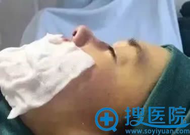 做隆鼻手术时的特写照片 做隆鼻手术时的特写照片