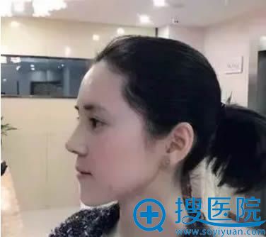 新疆华美王世宏帮我拆完线后的美照 新疆华美王世宏帮我拆完线后的美照