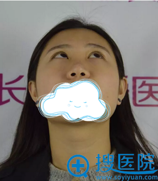 只是在长沙真爱做了个硅胶隆鼻 我的变化竟然这么大