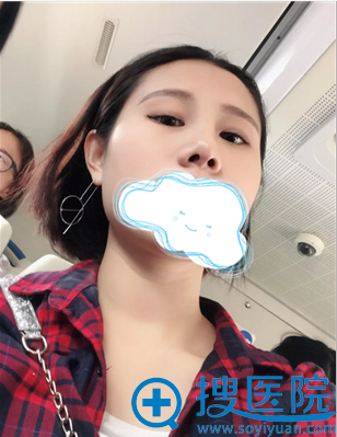 从鼻底看,鼻子都立体很多呢 从鼻底看,鼻子都立体很多呢