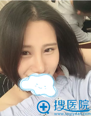 手术一个月了,臭美下 手术一个月了,臭美下