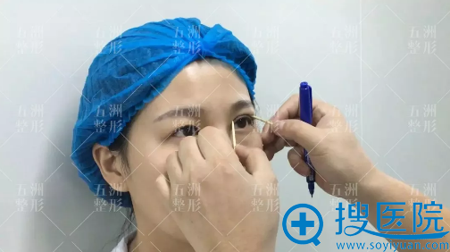 王志院长为我做术前设计 王志院长为我做术前设计