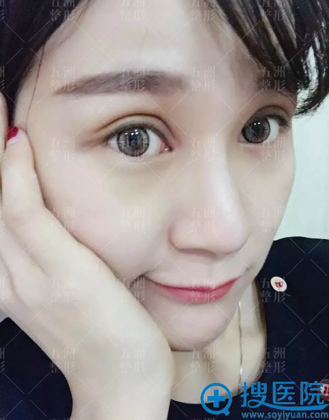 双眼皮术后7天恢复情况 双眼皮术后7天恢复情况