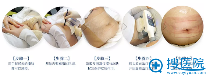 胖子可以变成
