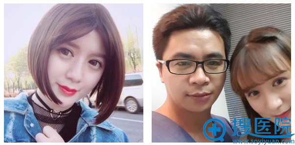 双眼皮两个月和杨小顺医生合影 双眼皮两个月和杨小顺医生合影