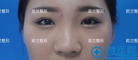 化了鼻影,鼻子依旧又宽又塌 化了鼻影,鼻子依旧又宽又塌