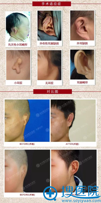 手术适应症与术后对比 手术适应症与术后对比