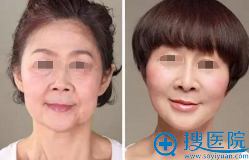线雕前后效果对比 线雕前后效果对比