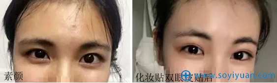 做双眼皮前素颜、化妆照对比 做双眼皮前素颜、化妆照对比