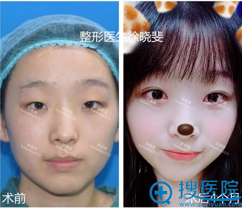 <!--<i data=20240710 data-id=14211></i>-->��������������۾�����