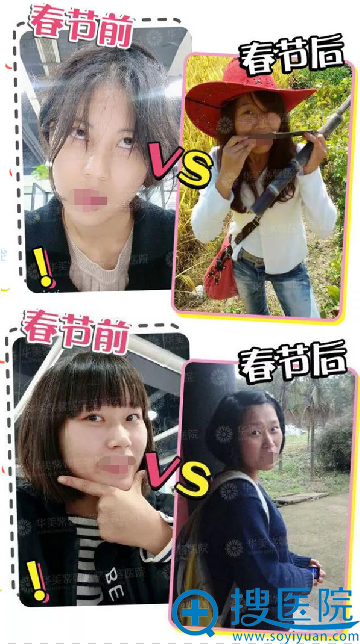 想做女神颜值不够?华美紫馨3月整形价格钜惠帮您轻松改变