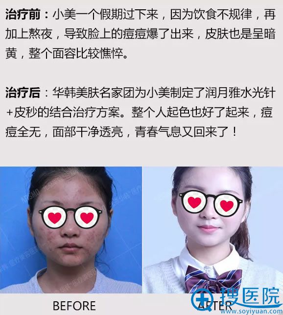 北京华韩美肤修复真人案例 北京华韩美肤修复真人案例