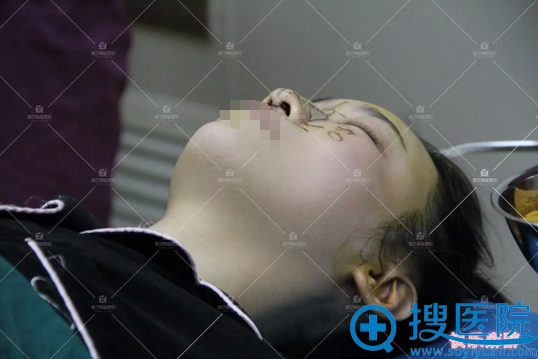 术前进行快乐麻醉 术前进行快乐麻醉