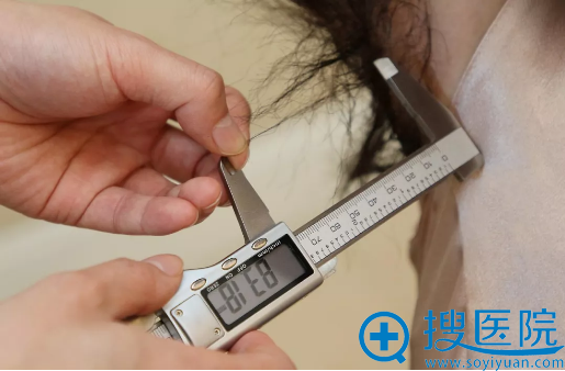 妙龄少女居然满脸胡子?想漂亮到温州艺星做了无痛冰点脱毛