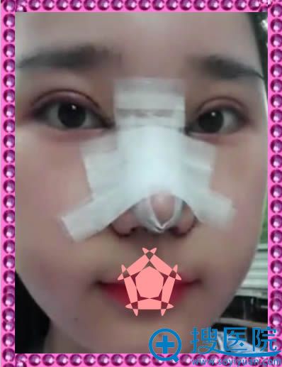 ���п�˫��Ƥ����������Ѿ������˺ܶ�