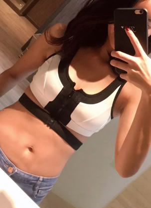 对比了假体和脂肪隆胸案例效果 选择青岛华颜美五维美胸过程