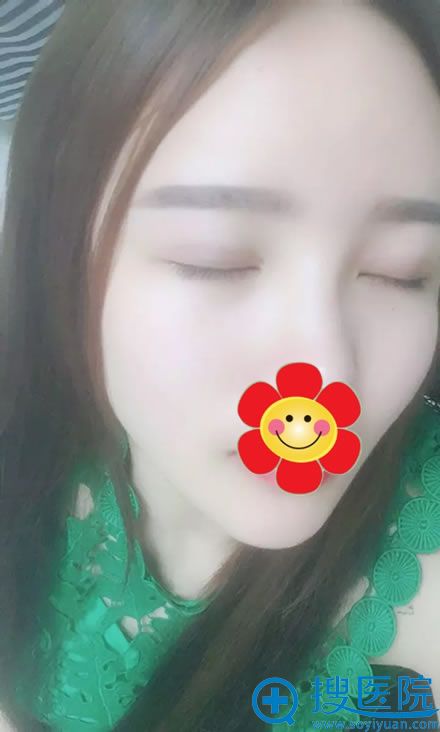 ˫��Ƥ�޸�������4��̺ۻָ���