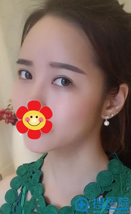 ���ֻ���˫��Ƥ�̺��޸�����