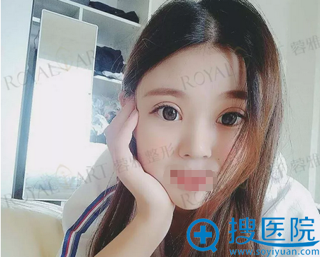 �鶯�ű����۲��ߺ�Ч��