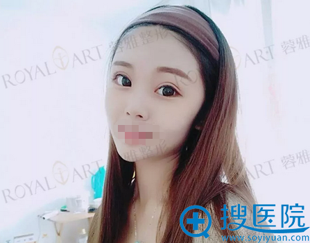 ���������鶯�ű���������4����Ч��