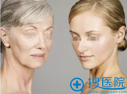 线雕前后案例对比 线雕前后案例对比