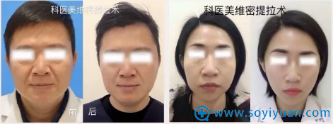 线雕前后案例对比 线雕前后案例对比