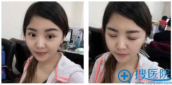 �ҹ����������˫��Ƥ20�칤����