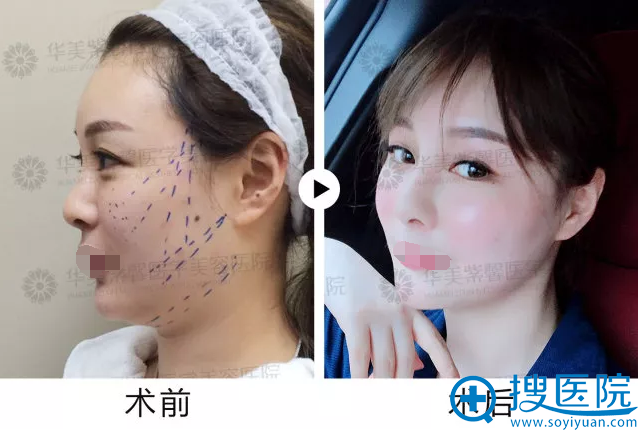 ˫M�ߵ�˥ǰ��