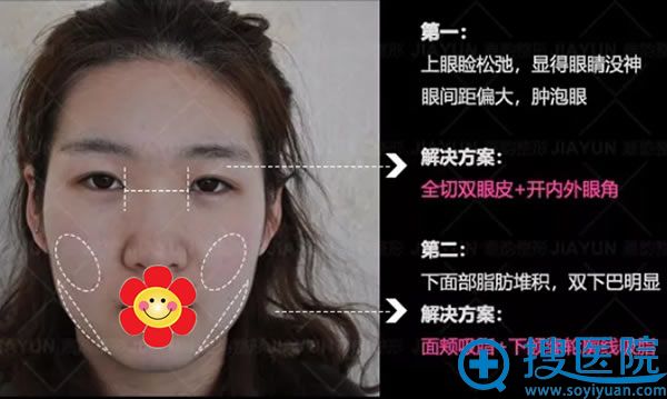 <!--<i data=20240710 data-id=7767></i>-->谢惠彬院长手术方案 <!--<i data=20240710 data-id=7767></i>-->谢惠彬院长手术方案