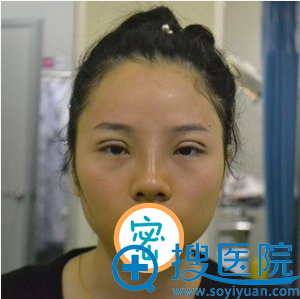 ��ɳЭ����Ц���п�˫��Ƥ+���۽ǲ��ߺ�Ч��