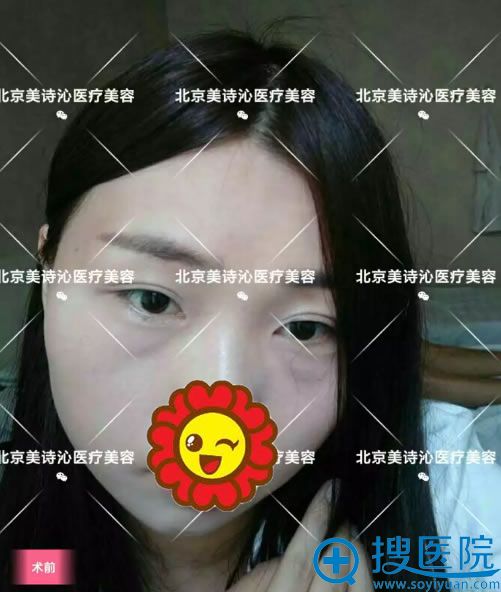 ���۴�֮ǰ����Ƭ