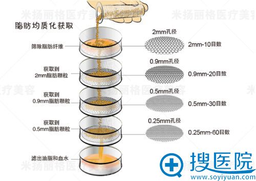 夏正义均质化脂肪移植技术 夏正义均质化脂肪移植技术