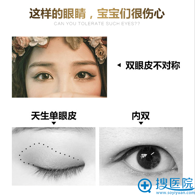 洛阳谁做双眼皮好?毛大夫私人定制手术方法给你萌动电眼