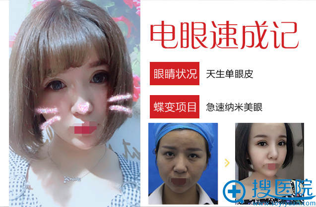 电眼美女前后对比 电眼美女前后对比