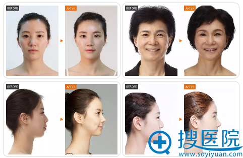 <!--<i data=20240710 data-id=11606></i>-->整形医院面部整形大师孙宇整形案例组图 <!--<i data=20240710 data-id=11606></i>-->整形医院面部整形大师孙宇整形案例组图