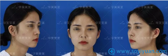 ������������������¡�Ƿ��°Ͱ��� ֻ��΢΢һ����ֵ��������