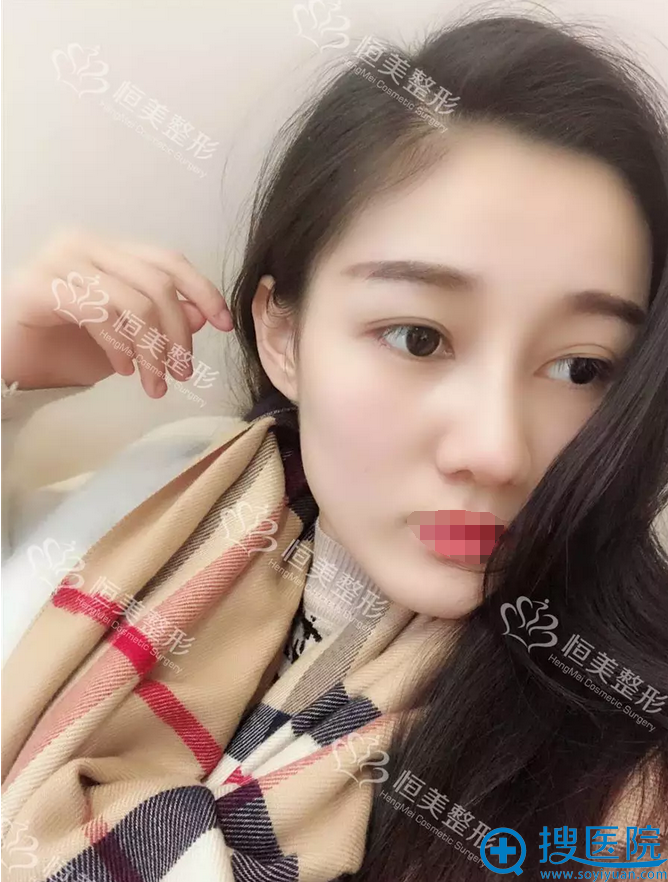 �������ͦ������