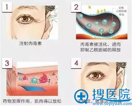 ���������벽�跽��