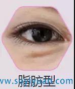����֬�������֬�����۴�