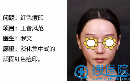 ���������������߷緶����ȥ��ӡЧ����� ���ϵĶ�ӡ����û��