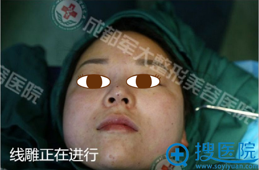 <!--<i data=20240710 data-id=15150></i>-->整形周斌院长线雕书中 <!--<i data=20240710 data-id=15150></i>-->整形周斌院长线雕书中