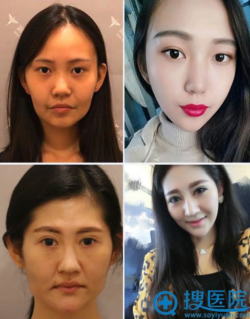 北京润美玉之光面部<span style= 北京润美玉之光面部<span style=