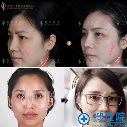 北京叶子面部<span style= 北京叶子面部<span style=