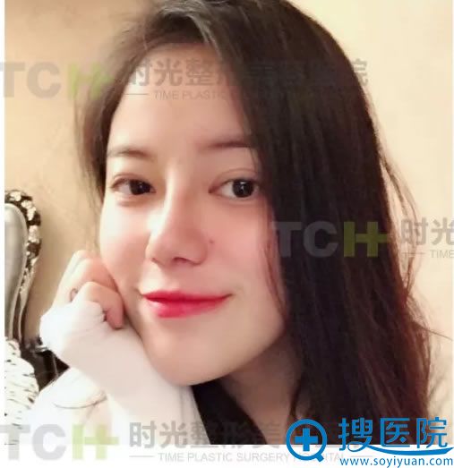 重庆时光陈玉连院长鼻综合案例15天效果 重庆时光陈玉连院长鼻综合案例15天效果